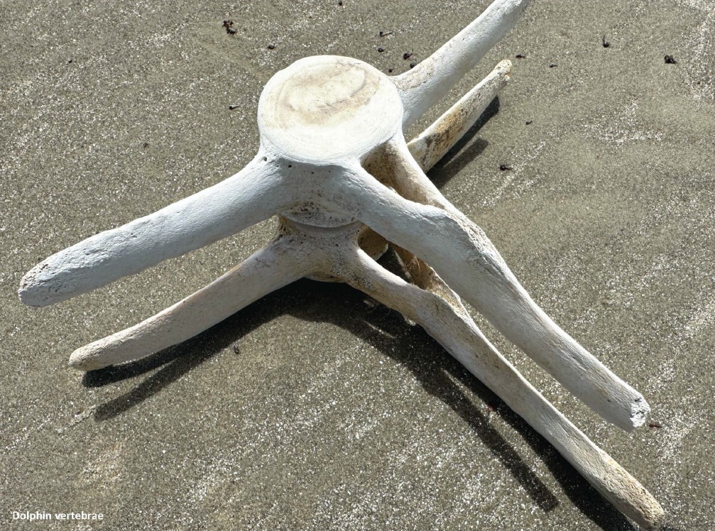 Bones